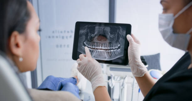 Licensed Teeth Cleaning And Checkup service in Montclair State University, NJ - Smile Center Dentistry